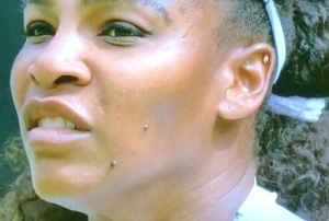 Those things on Serena Williams' face that she does not have removed.  Photo by Karen Salkin.