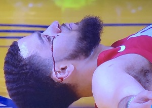 Fred VanVleet lying on the court right after he was hit. Photo by Karen Salkin.