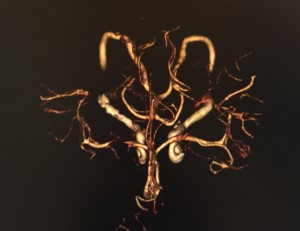 My brain! Photo by INAM staff.