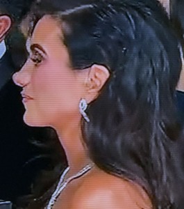 Poor Joelle Garguilo's unfortunate nose job. It looks sort-of like if Pinocchio had had one. Photo by Karen Salkin.