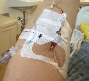 The strange little man icon on my IV tape! (He's upside-down, to try to fool me!) Photo by Karen Salkin.